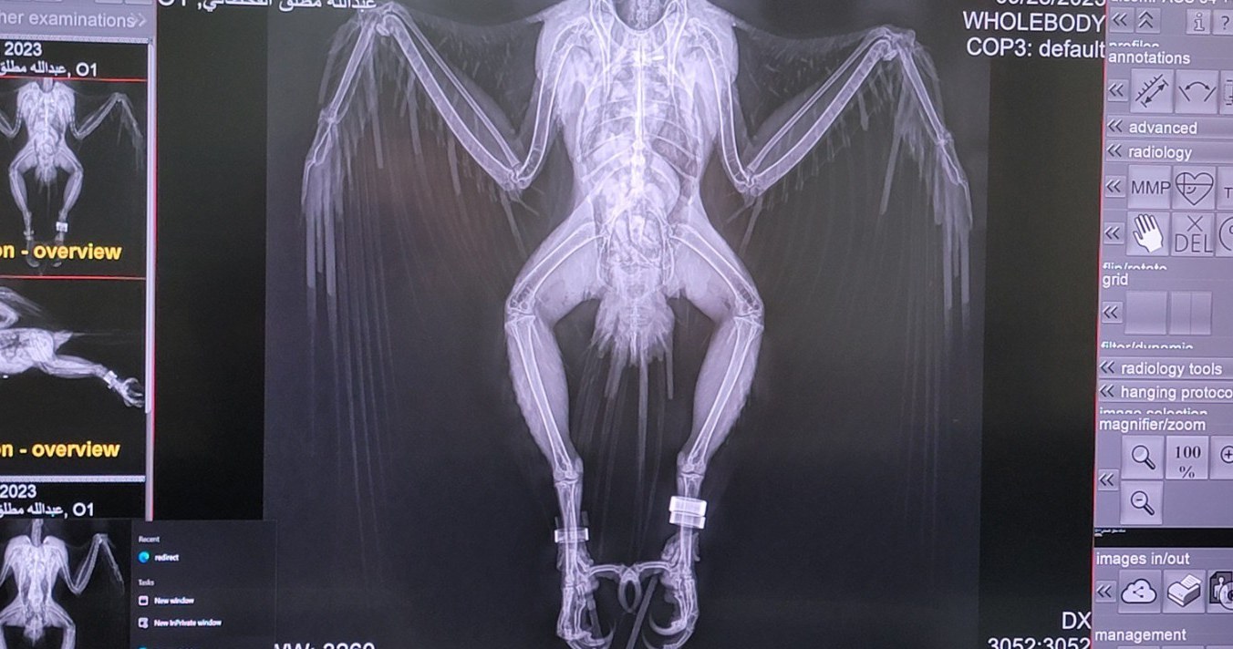 Falcon X-ray